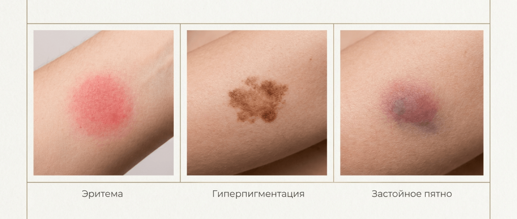 Editorial_medical_photo_triptych_collage_with_thre-1782773430644.png